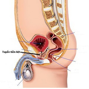 Các bệnh thuộc TUYẾN TIỀN LIỆT