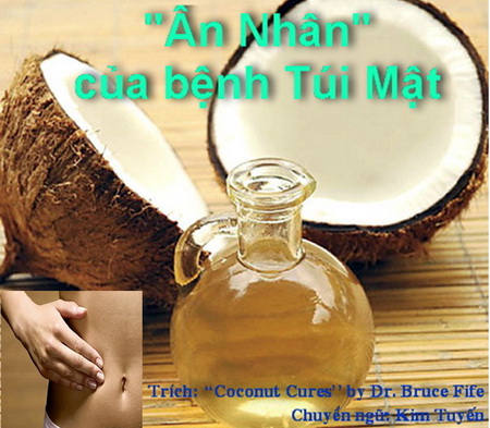 Ân nhân của bệnh túi mật: Dầu Dừa