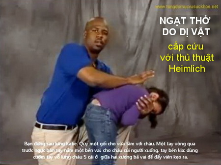 Ngạt thở do dị vật – cấp cứu với thủ thuật Heimlich