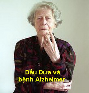 video Dầu Dừa chữa bệnh Alzheimer (bệnh suy giảm trí nhớ sớm)