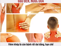 Đậu đen hấp trái dừa đặc trị viêm khớp, nhức khớp